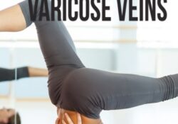 Yoga Poses For Varicose Veins